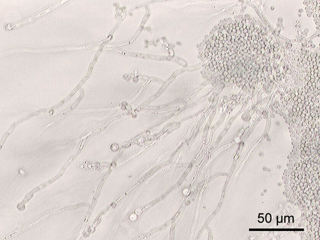 Candida Albicans
